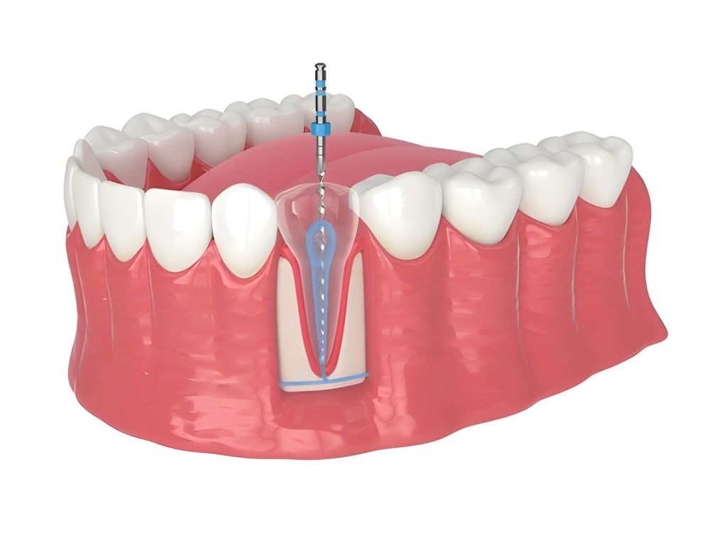 endodontics in brampton on