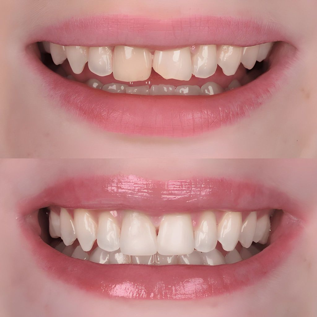 finding a quality restorative dentistry near you
